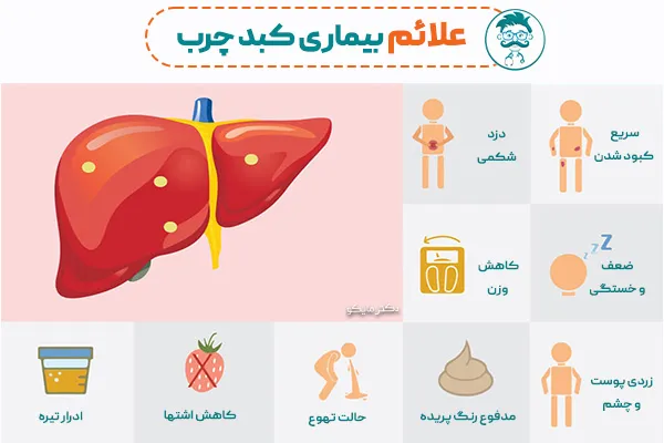 علایم کبد چرب